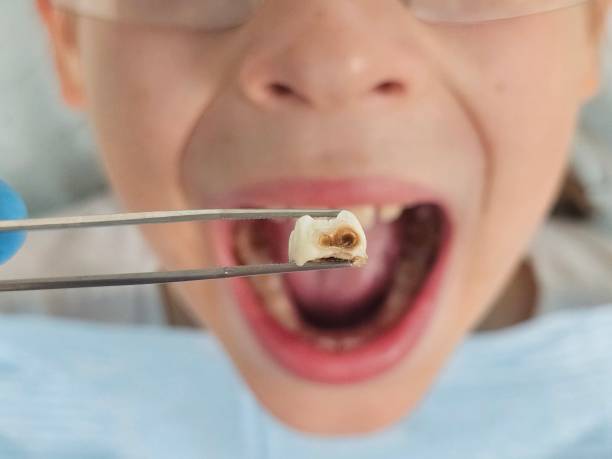 Best Emergency Orthodontic Repairs in Pleasant Ridge, MI